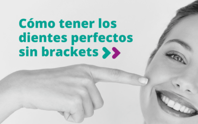 Cómo tener dientes perfectos sin brackets