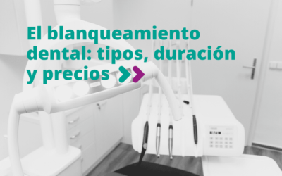 Blanqueamiento dental: precio, tipos y duración