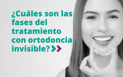 ¿Cuáles son las fases del tratamiento con ortodoncia invisible?