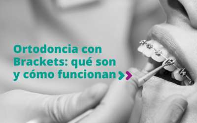 Ortodoncia con Brackets: qué son y cómo funcionan