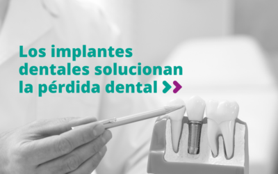 Los implantes dentales solucionan la pérdida dental