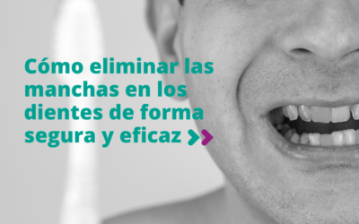 Cómo eliminar las manchas en los dientes de forma segura y eficaz