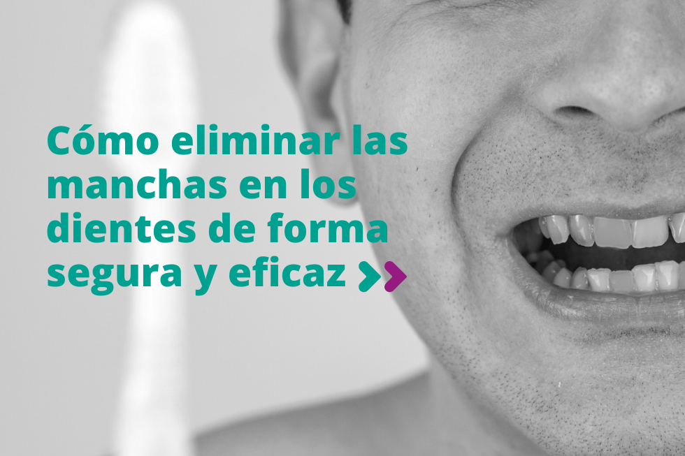 Cómo eliminar las manchas en los dientes de forma segura y eficaz