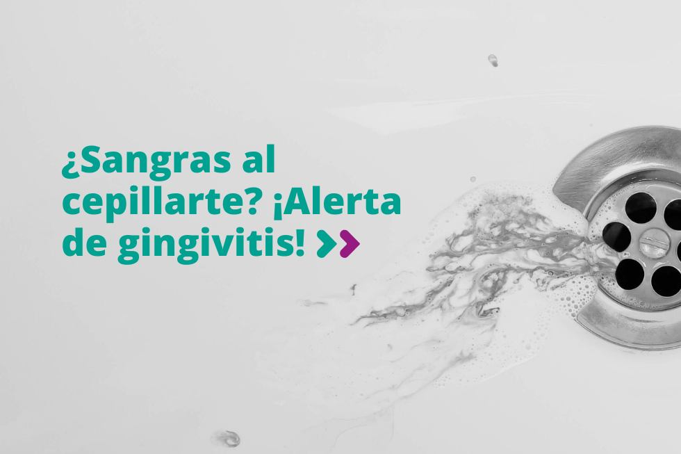 ¿Sangras al cepillarte? Alerta de gingivitis